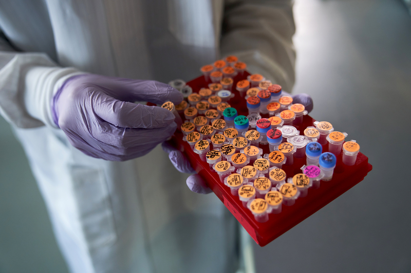 Nick Wang, lab assistant, works with samples in the Klein lab at UCSF